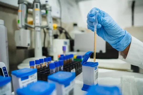 A sample is placed in a GeneXpert cartridge