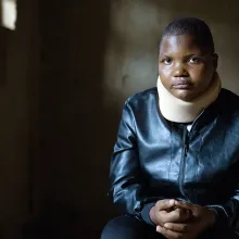Patient  received surgical care through support from Partners In Health in Rwanda