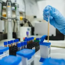 A sample is placed in a GeneXpert cartridge